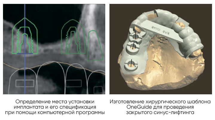 onecas benef 02 RUS