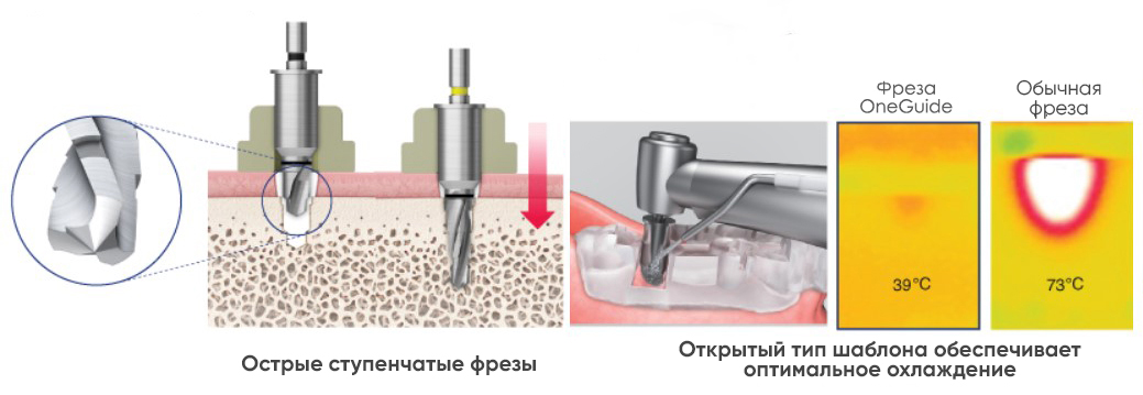 one guide benef 3