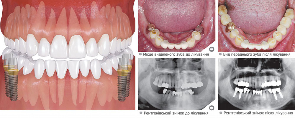 05 nesk nizhnie